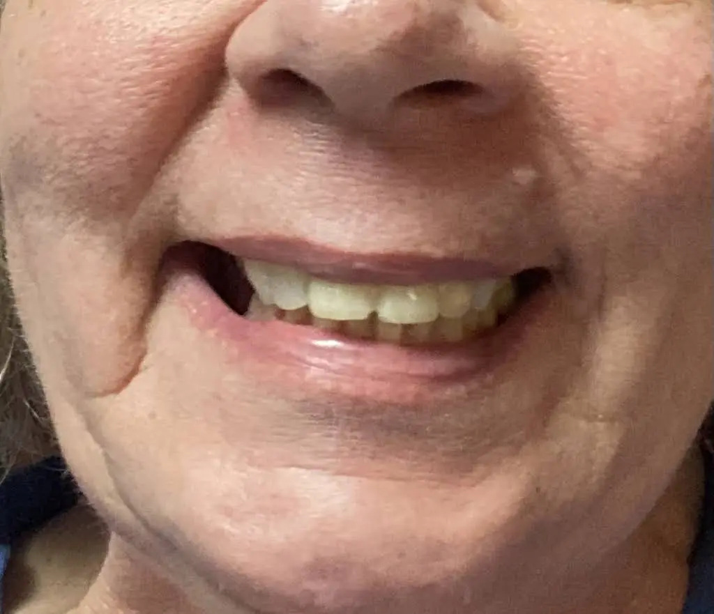 Neeley Dental LLC
