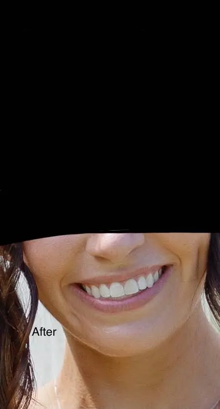 Georgetown Cosmetic Dentistry