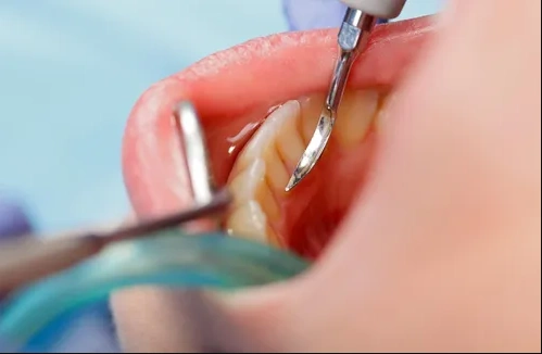 West End Dental