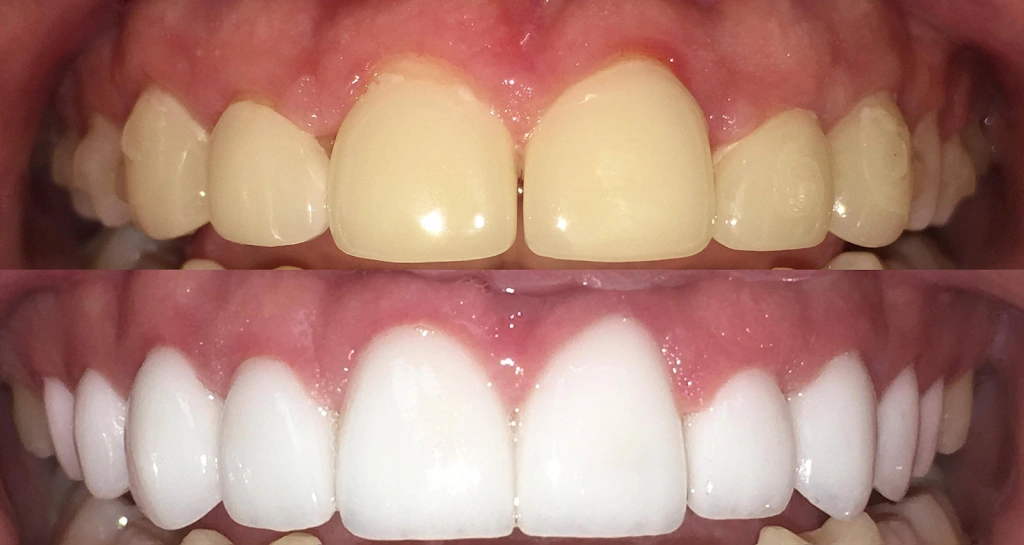 Pineview Dental Care