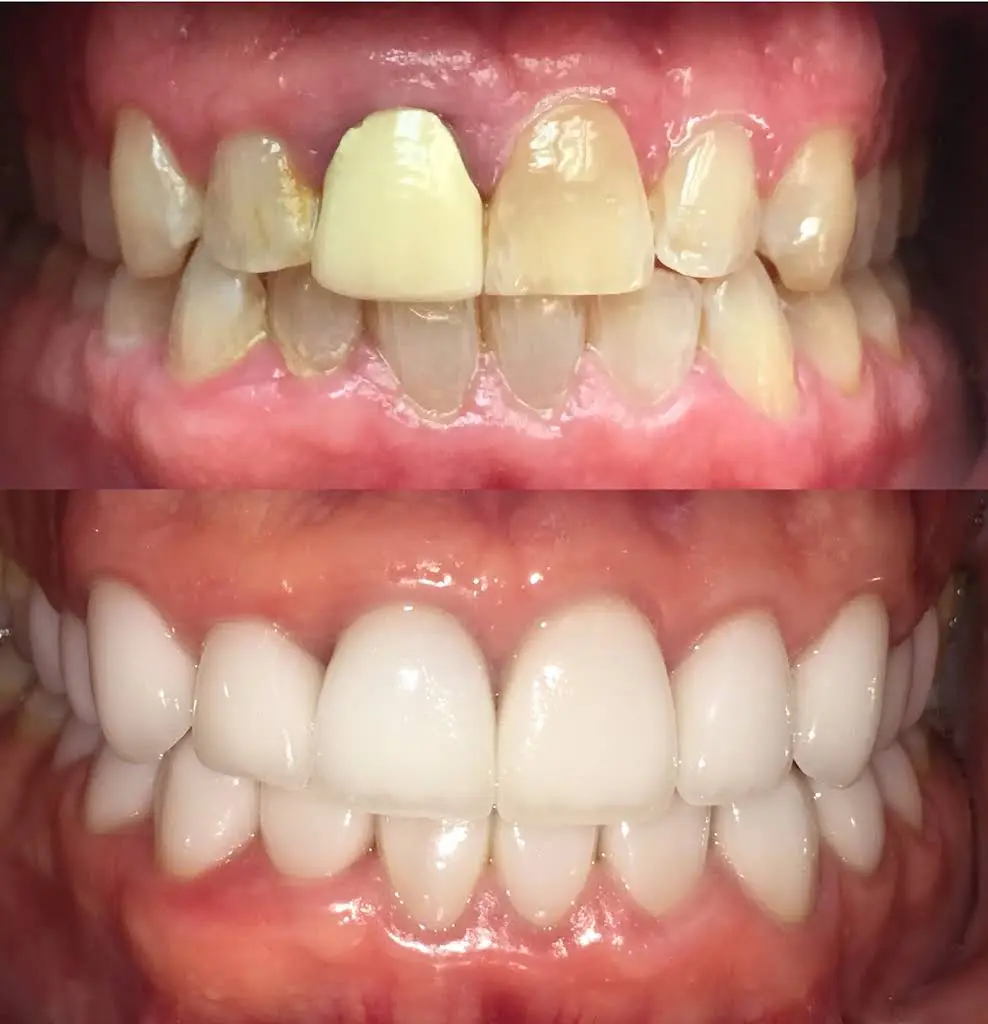 Pineview Dental Care