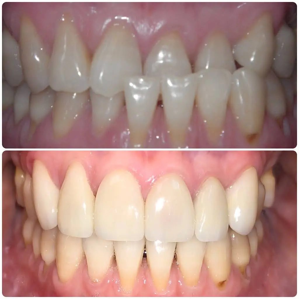 Pineview Dental Care