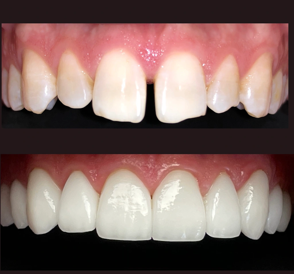 Pineview Dental Care