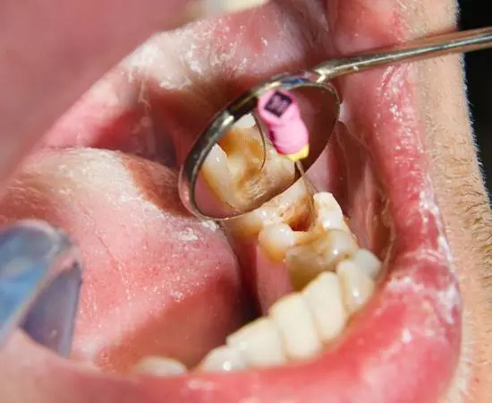 Meridian Dental Specialists