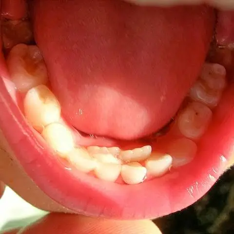 Total Dentistry