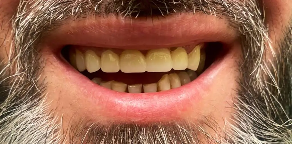 Family Dental of Palatine