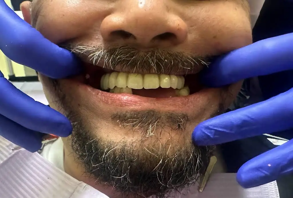 Family Dental of Palatine