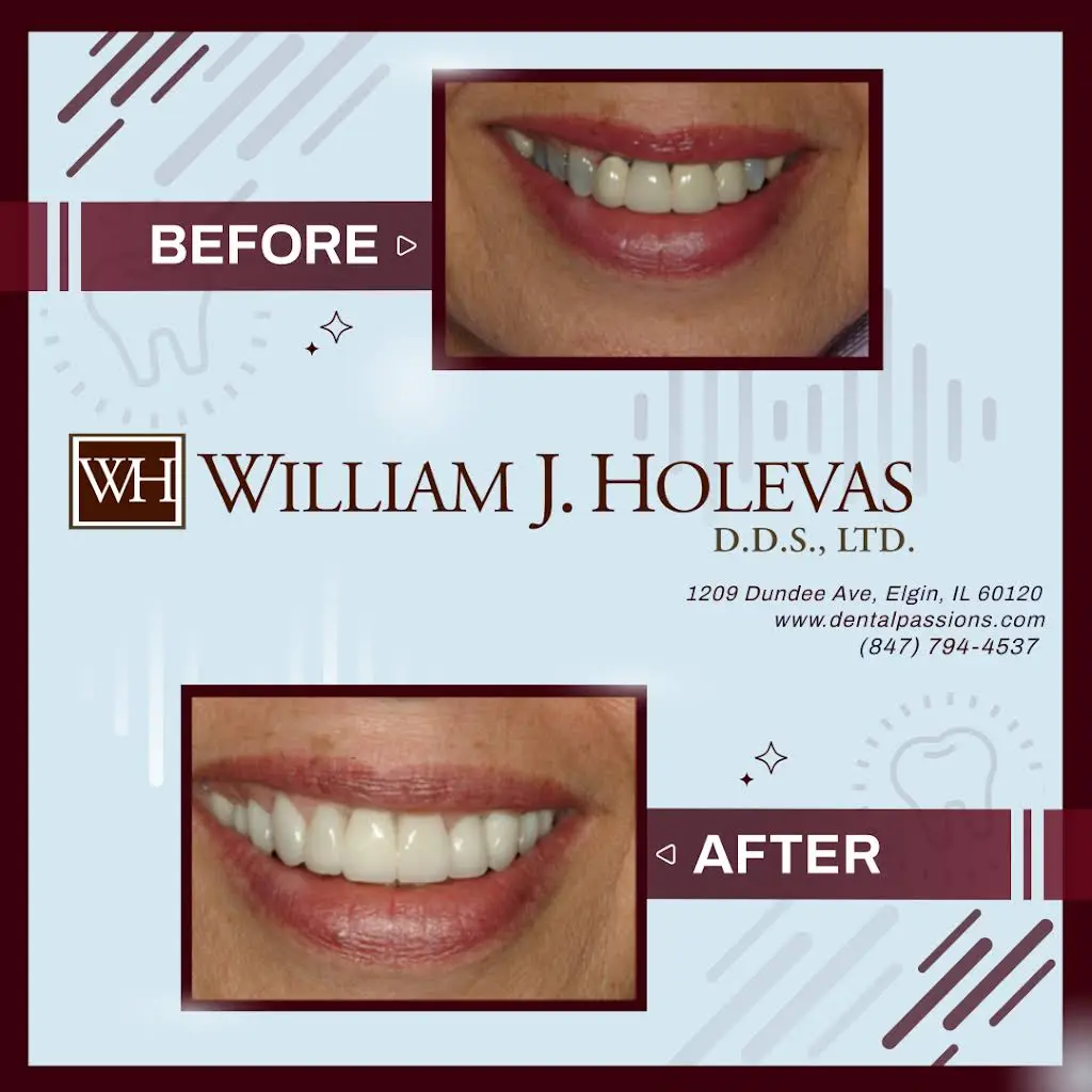 William J. Holevas D.D.S., LTD.
