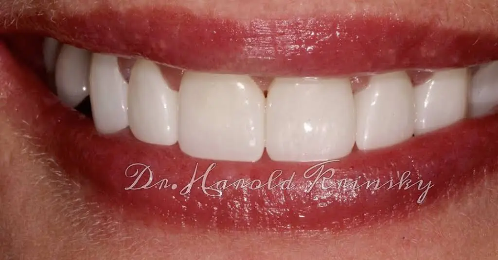 Webster Dental Care
