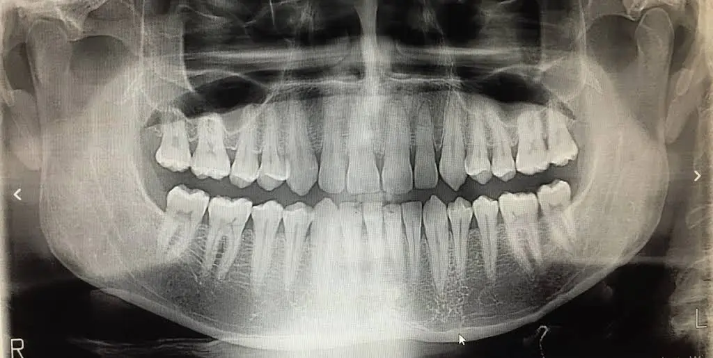 Full Smile Family Dentist