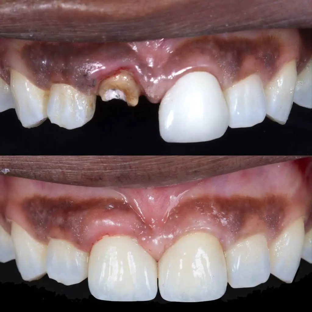 Healthy Dental Center