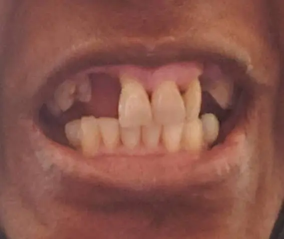 Cicero Dental Center