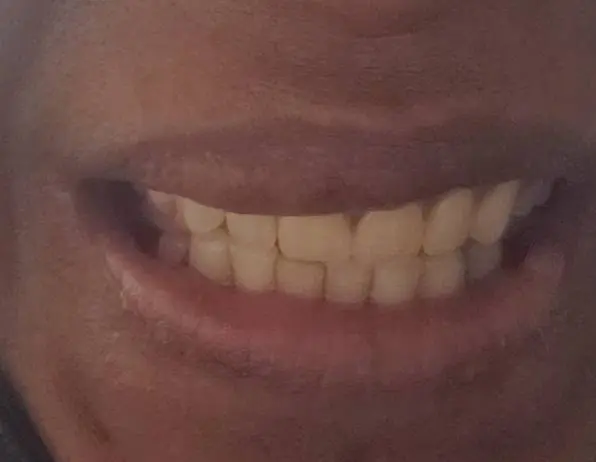 Cicero Dental Center