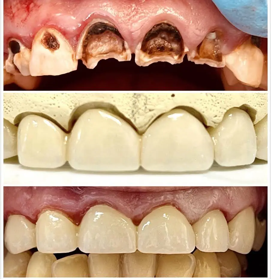 Summit Dental Smiles