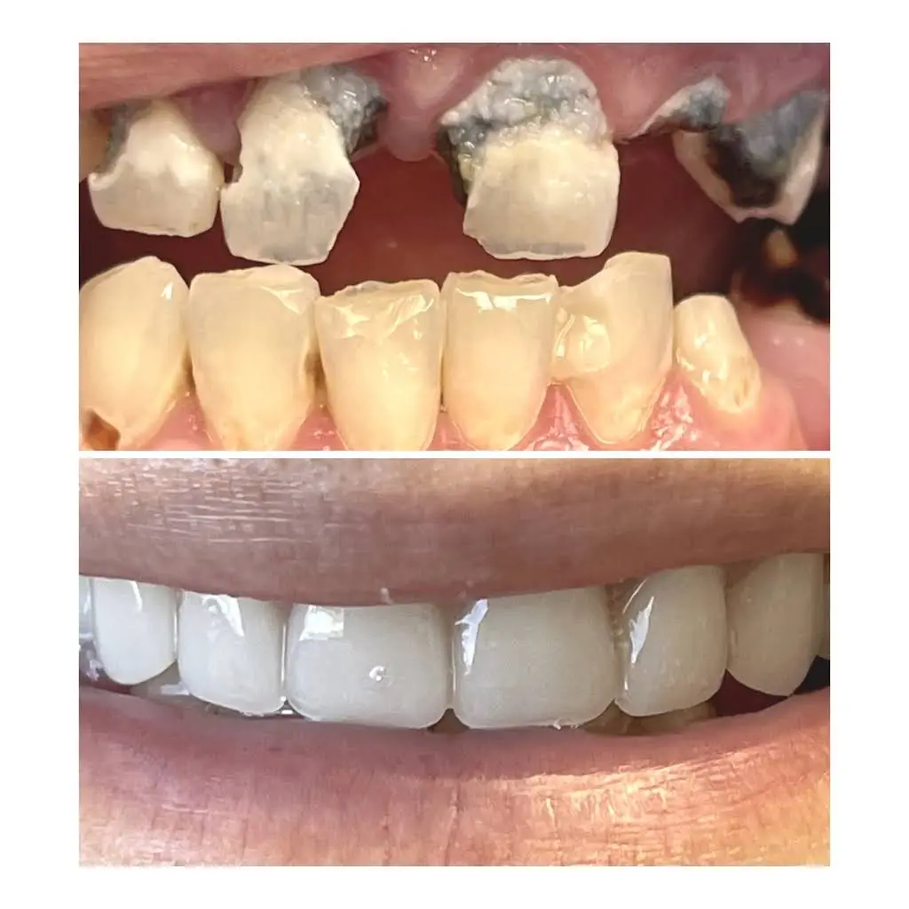 Summit Dental Smiles