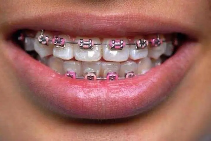 Midway Orthodontics