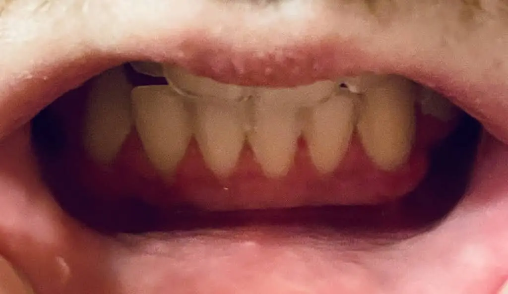 La Grange Periodontics