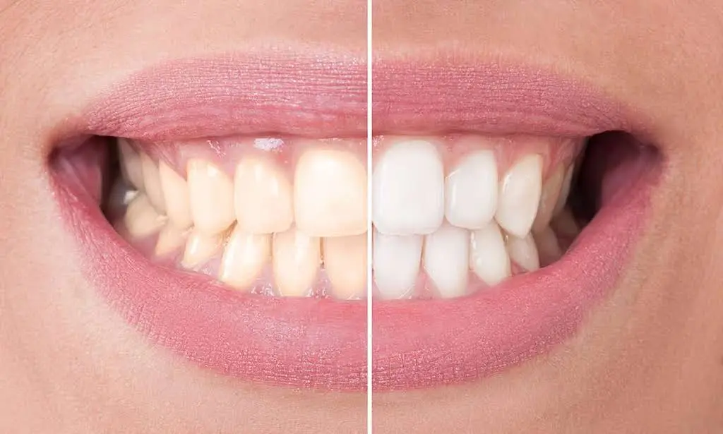 Diehl Family Dental