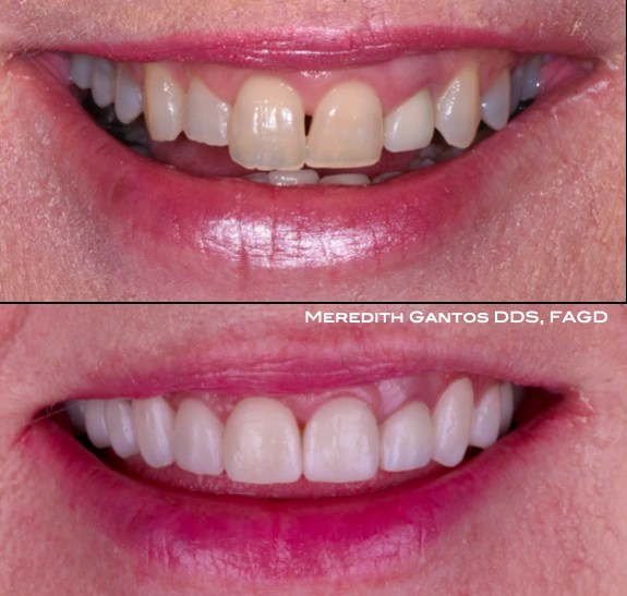 Gantos Dental Group