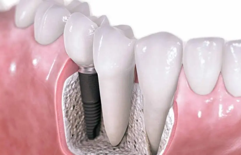 Young Family Dental Saratoga Springs