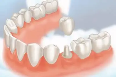 Young Family Dental Saratoga Springs