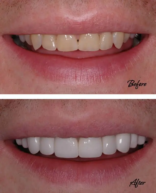 Mont Blanc Center For Dentistry