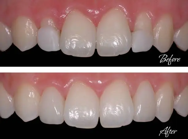 Mont Blanc Center For Dentistry