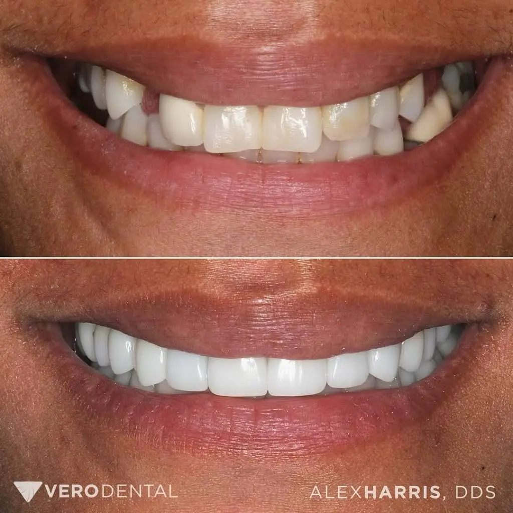 Vero Dental