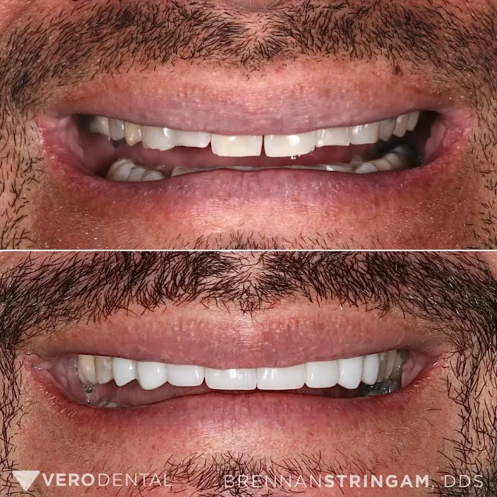 Vero Dental