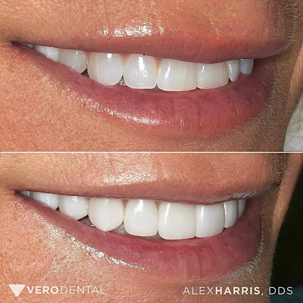 Vero Dental
