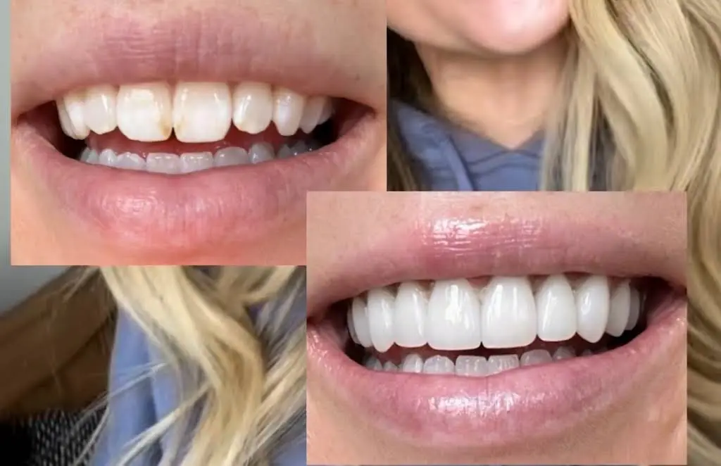 Vero Dental