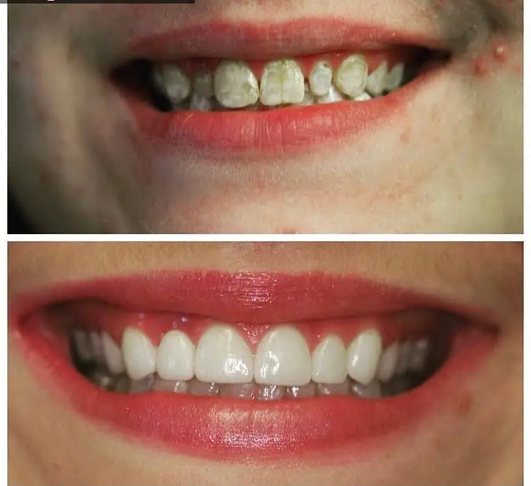 Spring Valley Dental
