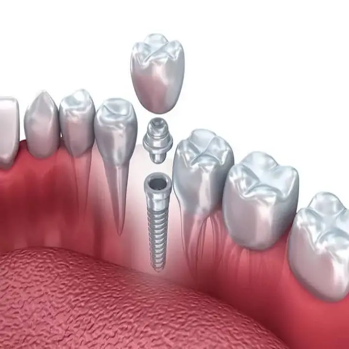 DC Implant & Cosmetic Dentistry