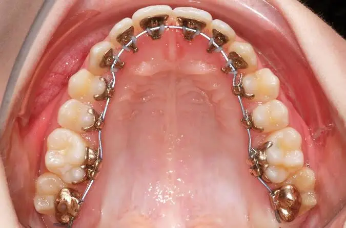 Orbach Orthodontics