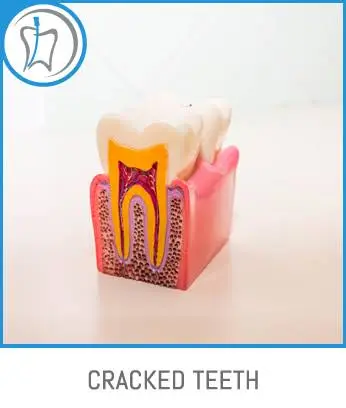 Ideal Endodontics