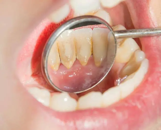 Morgantown Dental Group