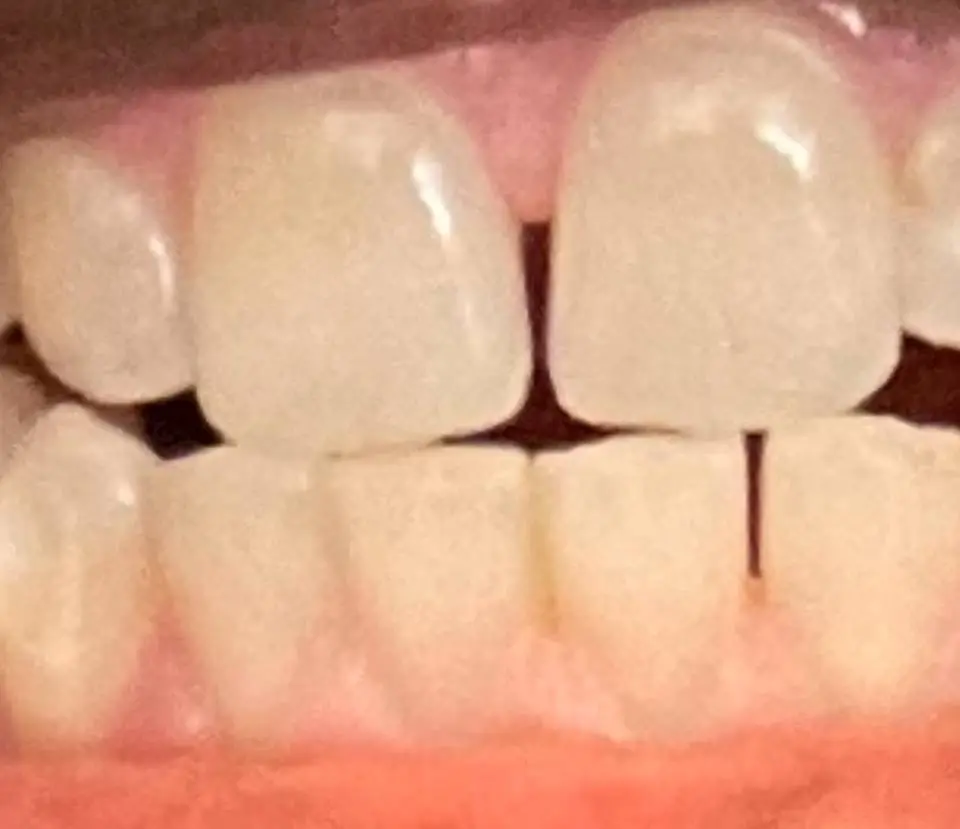 Aspen Dental