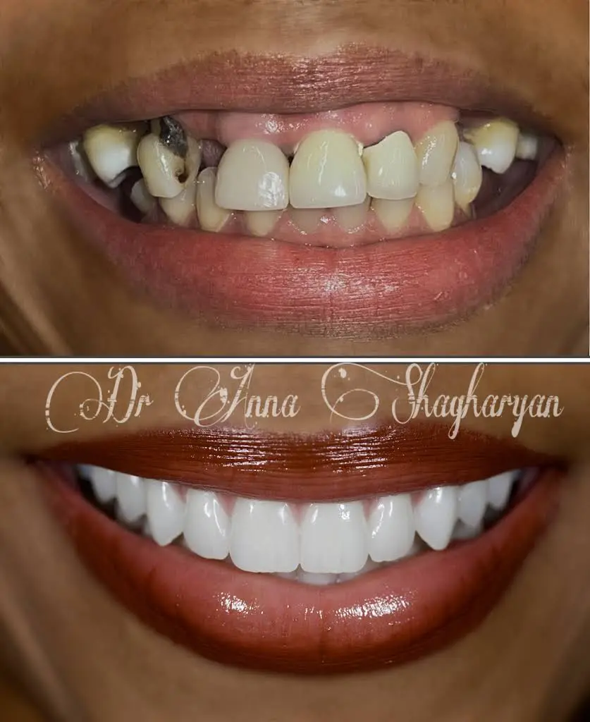 AVIVA Dental Implant Center