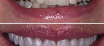 Las Vegas Aesthetic Dentistry