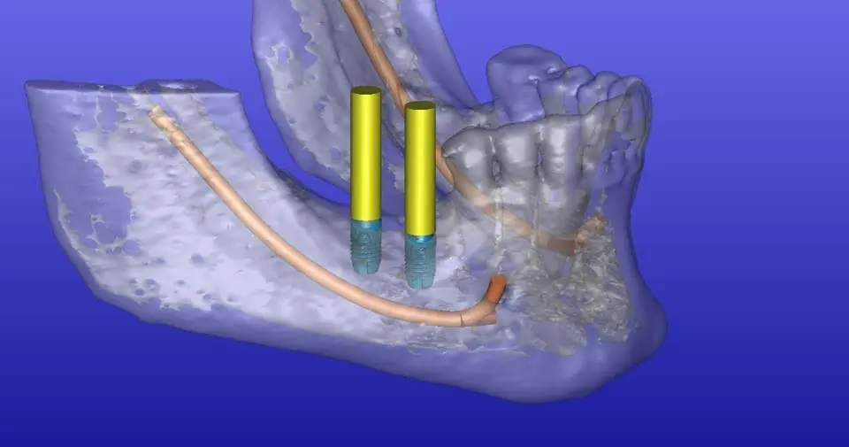 Seven Hills Dental & Implant Center