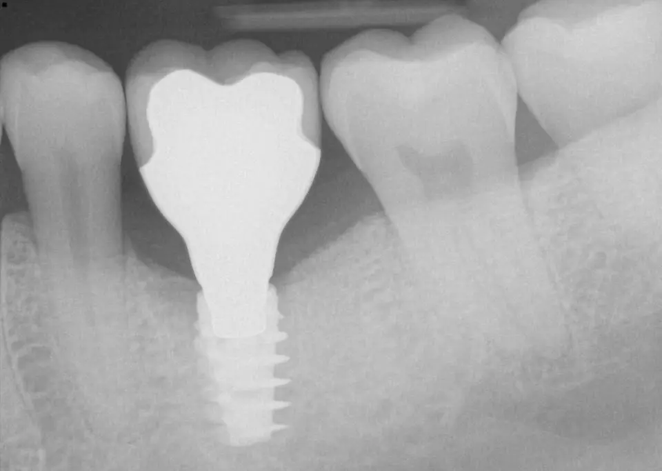 Seven Hills Dental & Implant Center