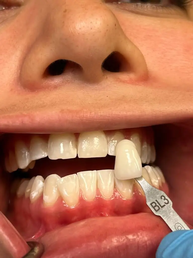 Metropolitan Dental Care