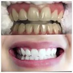 All Smiles Family Dental - Dr. Sandhya Pallam DDS