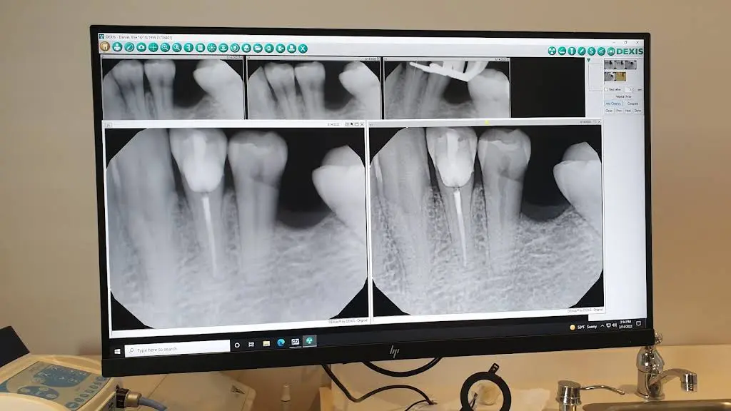Illinois Valley Endodontics, Dr. Lee Ceresa D.D.S.