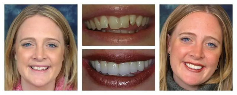 Lakota Dental