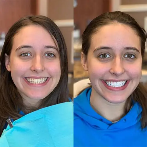 Lakota Dental