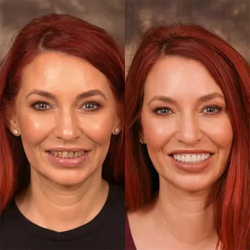 Lakota Dental