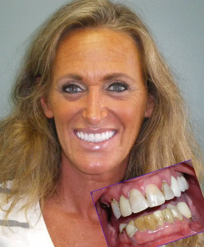 Advanced Center for Oral Surgery and Dental Implants - Dr. Spiro Karras & Dr. Maria Karras