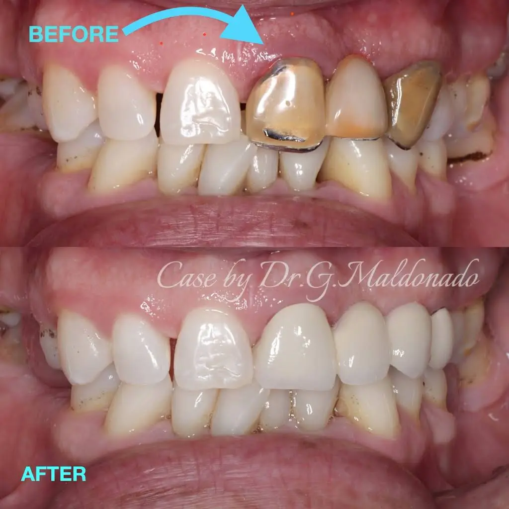 Dentistas Hispanos