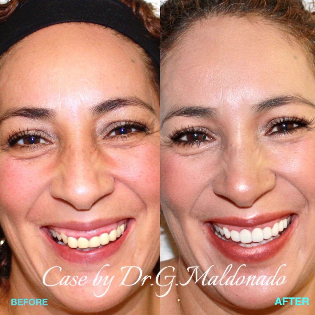 Dentistas Hispanos